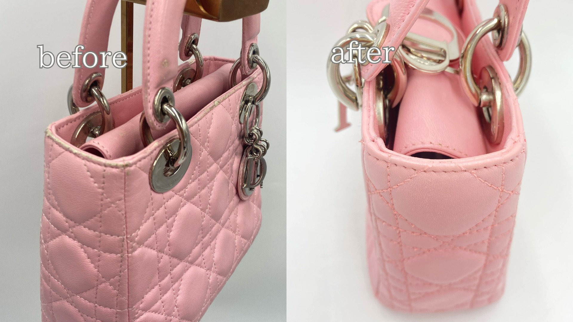 レディディオール 黒ずみ(ビフォー)